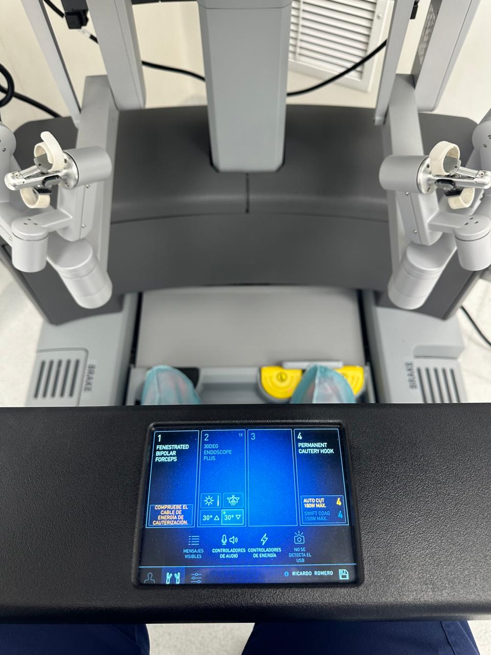 Beneficios de la cirugía robótica